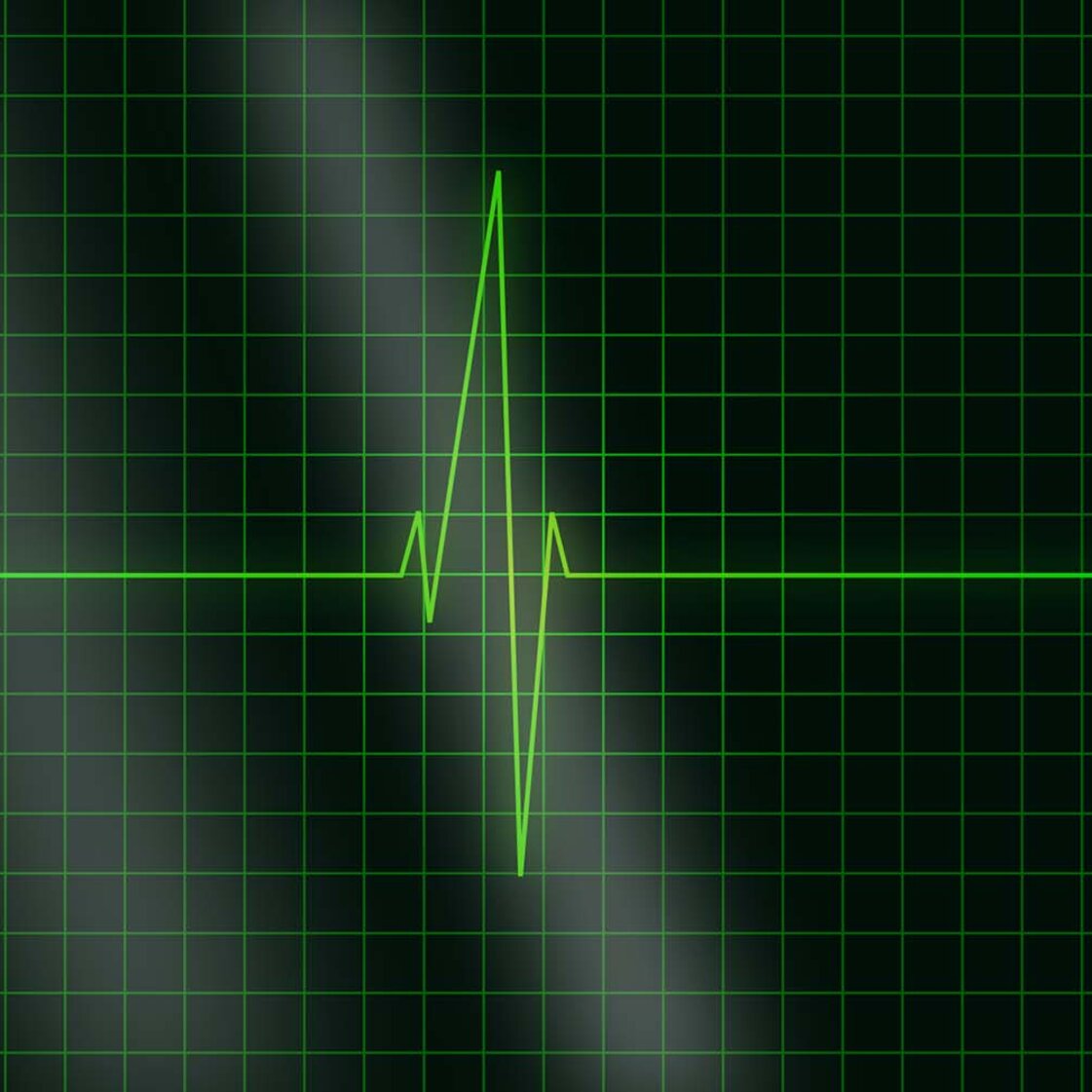 PMU Open House: EKG zum Angreifen
