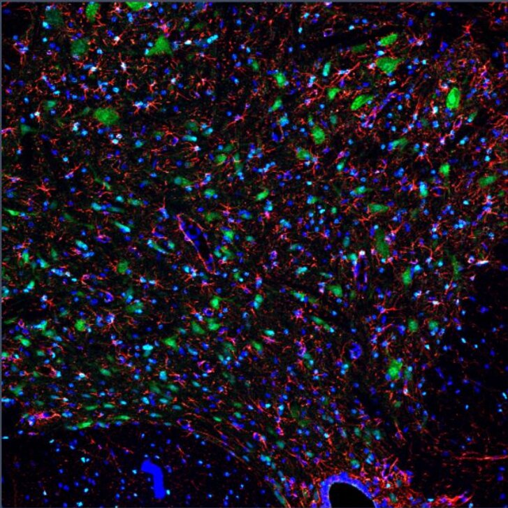 Multifluoreszenzbild von Gewebe