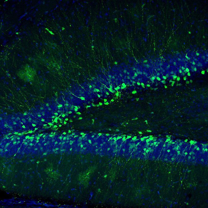 Nervenzellen im Hippocampus Grün gefärbte Nervenzellen im Hippocampus